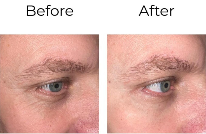 Crème contour des yeux Peptilux Anti-Falten de Chogan, 20 ml, soin visage et corps pour réduire rides et ridules.