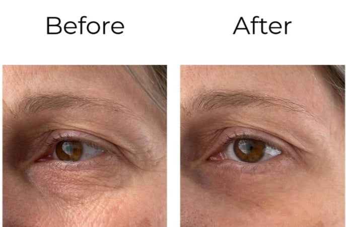 Crème contour des yeux Peptilux Anti-Falten Chogan, 20 ml, soin visage anti-rides pour peau sensible.